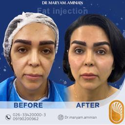 تصویر گالری مریم امینیان 4
