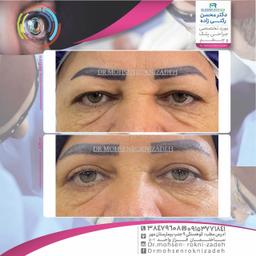 تصویر گالری محسن رکنی زاده 5