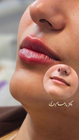 تصویر گالری سیدپرهام احمدی 1