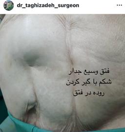 تصویر گالری محمدرضا تقی زاده 11