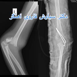 تصویر گالری سیاوش قاروی آهنگر 2