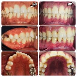 تصویر گالری طیبه مماوی 6