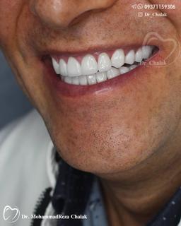 تصویر گالری محمدرضا چالاک 6