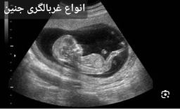 تصویر گالری نسرین امینی 21