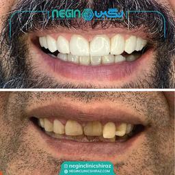 تصویر گالری نگین اثنی عشری 5