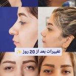 تصویر گالری اشکان یزدان پناه حمیدآباد 14