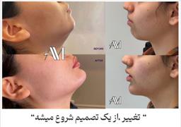 تصویر گالری امیر مشعوفی 2