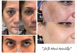 تصویر گالری امیر مشعوفی 4