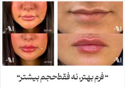 تصویر گالری امیر مشعوفی 3