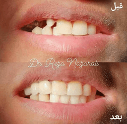 تصویر گالری رضا نظرعلی 7
